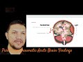 🇦🇫part 3 عاجل خونریزی مغز non traumatic acute brain finding in emergency lectures dr. musa