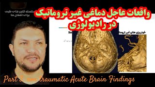 🇦🇫part 3 عاجل#خونریزی #مغز# #Non-Traumatic #ACUTE #BRAIN  FINDING in #Emergency #Lectures #Dr. #Musa