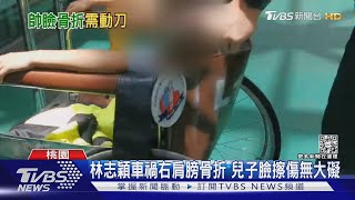 帶兒子比卡丁車遇車禍！林志穎顏面、右肩骨折、輕微腦震盪｜TVBS新聞