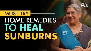 SunBurn Home Remedies | How to Treat SunTan Naturally at Home?