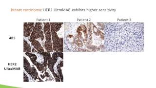 Webinar: New Tool for Antibody Specificity Testing