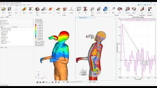 Simulating the impact of a Mike Tyson punch - Altair Radioss