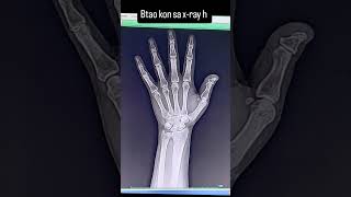 #xraytechnician #xray #hospitalemployee #yutubeshorts #viralvideo