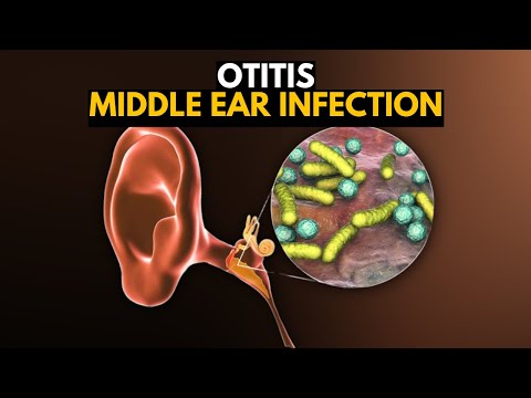 How many ear diseases are there?