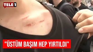 Tokatköy'de darp edilen genç anlattı: Ayırmak için araya girdiğimde yere düşürüp tekme attılar