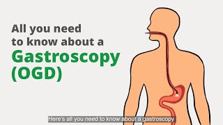 Gastroscopy (OGD): What is it for, and what should I expect?