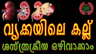 വൃക്കയിലെ കല്ലുകള്‍ I മൂത്രാശയ കല്ലുകൾ I KIDNEY STONE I കാരണം I പരിഹാരം I ശ്രദ്ധിക്കേണ്ട കാര്യങ്ങൾ