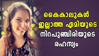 കൈകാലുകൾ ഇല്ലാത്ത ഏമിയുടെ നിറപുഞ്ചിരിയുടെ രഹസ്യം | Faith Witness | Shekinah Television