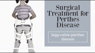 Surgical treatment for Perthes disease