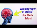 10 warning signs of stroke|Stroke a week before it happens|Unbelievable signs|Symptoms of stroke