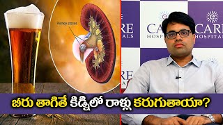 BEER helps in removing kidney stone? Dr Rahul Dubbaka II Mee doctor