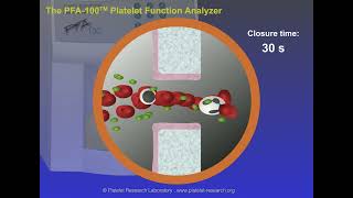 The Platelet Function Analyzer PFA-100® System