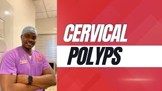Cervical Polyps - With Dr. Collins Aboloje - St. Ives Health Bites: Episode 15