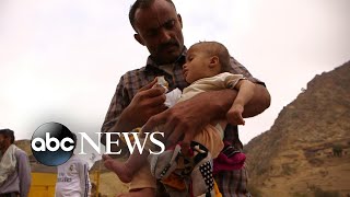 Inside Yemen's civil war where 8 million people are on the brink of starvation