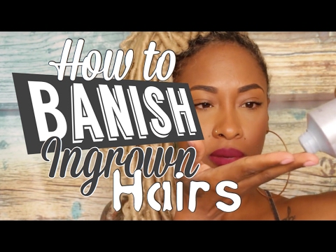 5 Steps to BANISH Ingrown Hairs that WORKS 5 Steps to BANISH Ingrown Hairs that WORKS