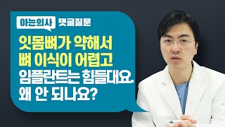 잇몸뼈가 약하면, 뼈이식도 힘들까? 임플란트할때 뼈이식이 안 되는 경우는?