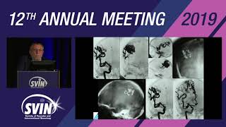 SVIN 2019: History of Neurointerventional Surgery and Looking Forward to the Next 100 years