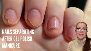 Nails separating after gel polish [Nail Technician explains]