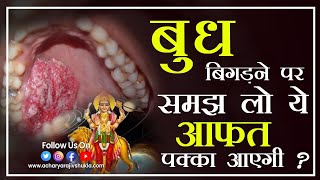 kharab budh ke lakshan । kamjor budh ke lakshan । weak mercury symptom । debilitated mercury effect