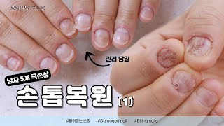 Eng sub) part 1/ Restoring the Nails of a Male Customer with Severe Nail Damage