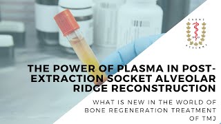 The power of plasma in post-extraction socket alveolar ridge reconstruction