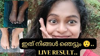 Pedicure Result | ഇത് നിങ്ങൾ ഞെട്ടാൻ തയ്യാറാണോ goooyiieessss 😲😲... ഞങൾ ഞെട്ടി കുട്ടിമാമ 🤓