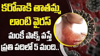 భారత్‌కు మంకీపాక్స్ ముప్పు! | Monkeypox In India, What Now? | Monkeypox Symptoms | Socialpost Health