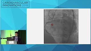 CVI2018 Session: Microcatheter entrapment - Wissam Jaber, MD