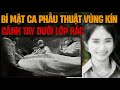 Kỳ Án Trung Quốc: Bí Mật Đáng Sợ Sau Cuộc Phẫu Thuật Vùng Kín