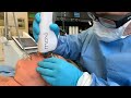 SCITON MOXI: THE MOST ADVANCED LOW DOWNTIME LASER FOR PIGMENTATION, PORES, WRINKLES | Dr. Jason Emer