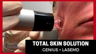 Total Skin Solution - Genius + LaseMD