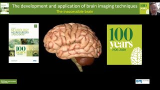 Brain Imaging: The development and application of imaging techniques