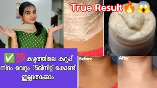 💯ഒരൊറ്റ use ൽ ഞെട്ടിക്കുന്ന മാറ്റം ലഭിക്കുന്നു🔥||Neck whitening at home||Remove black colour in neck