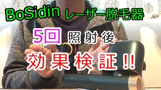 【Bosidin レーザー脱毛器】[5]効果検証～5回照射後の効果を発表します! 家庭用脱毛器ボシディン使用