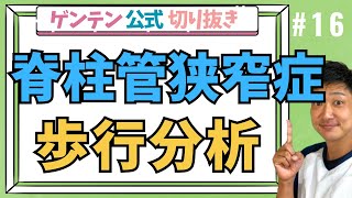 【ゲンテン切り抜き】脊柱管狭窄症の歩行分析！