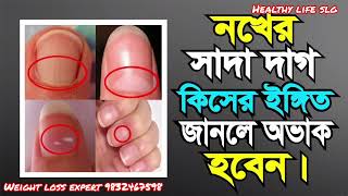 নখের নিচে সাদা দাগ হলে আপনার ভাগ্যের কি পরিবর্তন হবে? / Health Tips bangla / #viral #trending #Tips