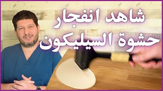 انفجار حشوات السيليكون؟