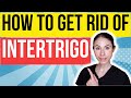 How To Get Rid Of Intertrigo Fast | Dermatologist Tips