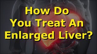 How Do You Treat An Enlarged Liver?