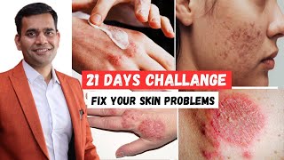 21 Days Challenge | Cure Your All Skin Problems  - Dr. Vivek Joshi