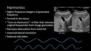 Ultrasound Physics - Image Generation