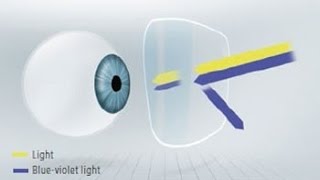 ZEISS DuraVision BlueProtect