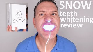 SNOW Teeth Whitening Review \u0026 Unboxing 2020 - Does Snow really work?