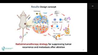 Xin Guan: Radiotherapy Synergizes with PD-L1 Blockade to Limit Post-ablation Cancer Recurrence