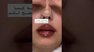 تصغير الانف وتقصيرها ولمها بطريقه فعاله جديده مؤكده