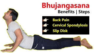 भुजंगासन क्यों और कैसे करें? - Bhujangasana Benefits, Steps and Precautions