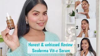 Most Honest review SESDERMA vit-C serum |A products that has changed my skin | liposomal Vit-c Serum