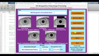 Iris Recognition Using Image Processing Matlab Project Code || Final Year Project | IEEE Projects