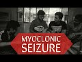 Myoclonic seizure | Types of seizures