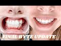 Last BYTE update! - year and half later!